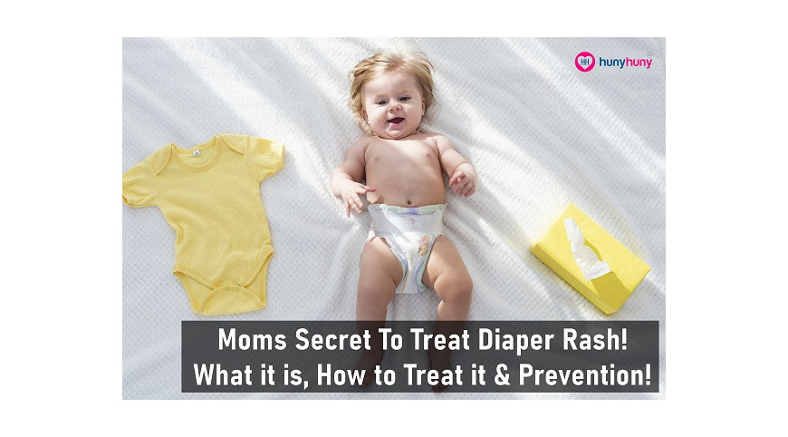 Moms Secret To Treat Diaper Rash! What it is,How to Treat it & Prevention!!